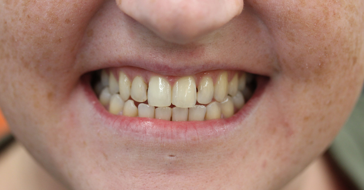 patient k before treatment islington dentist