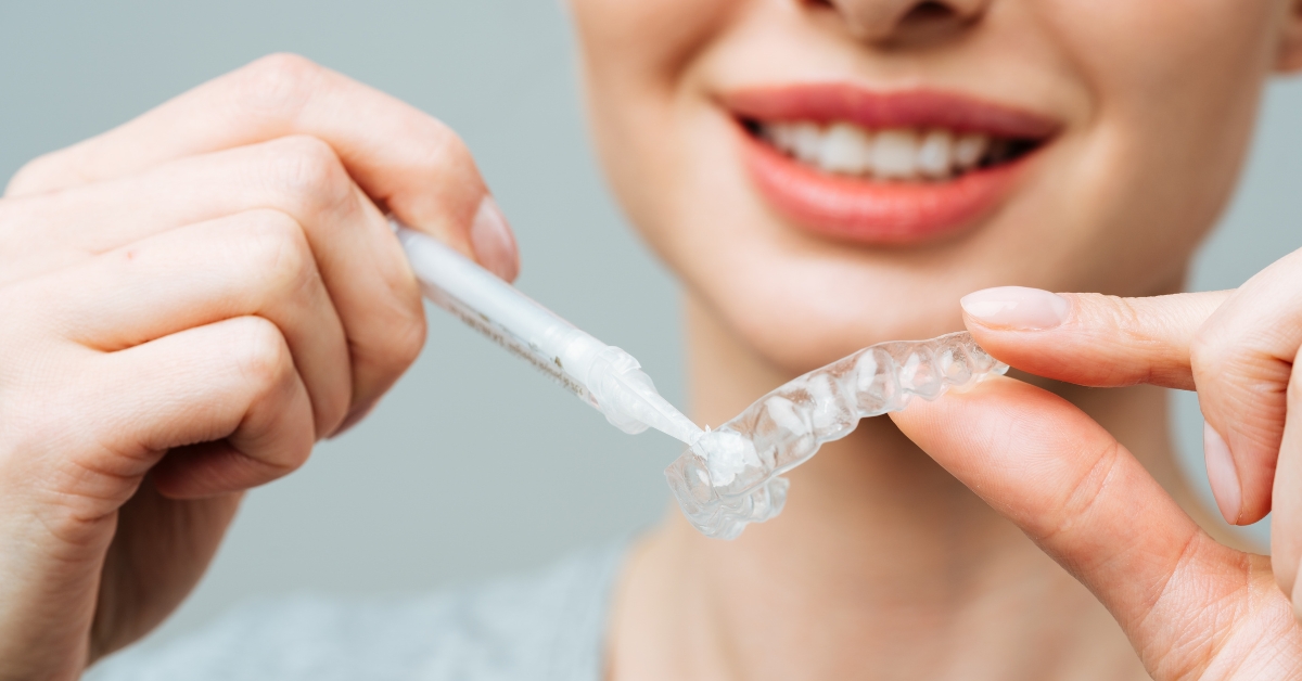 Professional Teeth Whitening vs Shop-Bought Products