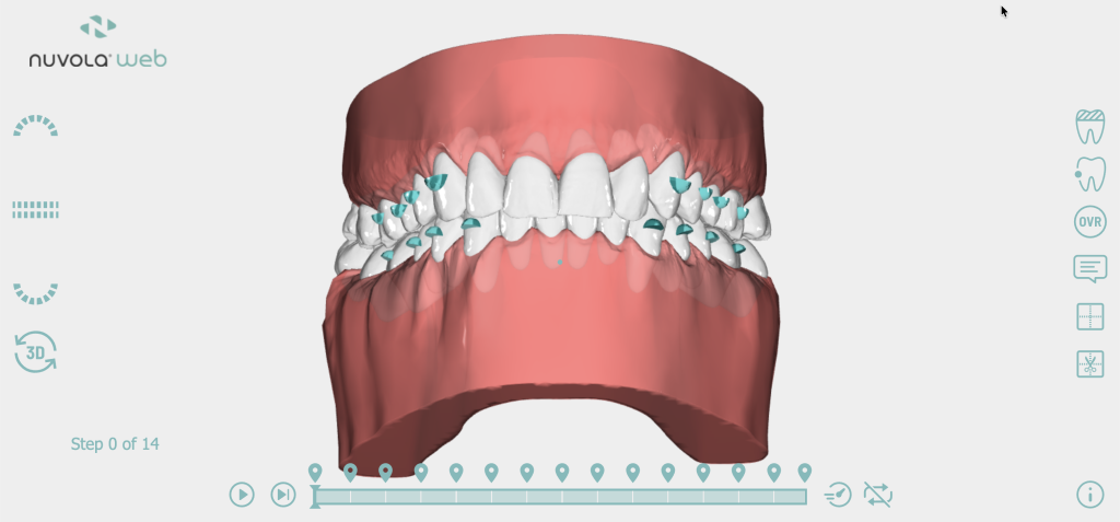 Invisalign vs Nuvola | NuvolaWeb, Nuvola's 3D planning platform