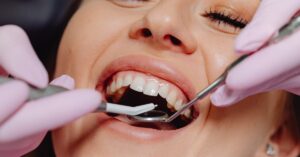 gum health